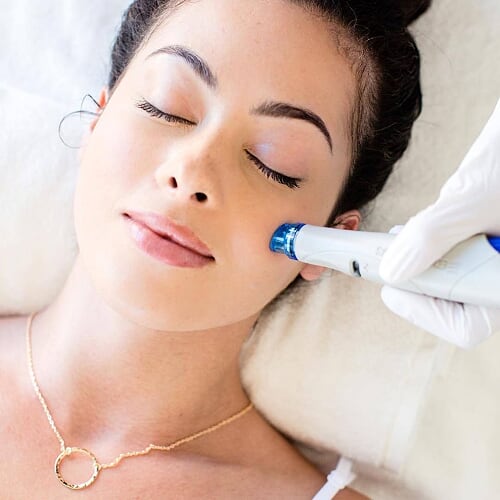 Frau erhält eine Hydrafacial-Behandlung – schonende Tiefenreinigung der Haut.